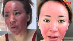 महिला ने 22 साल से नहीं उतारा चेहरे का मेकअप! अब स्किन का हो गया बुरा हाल, तस्वीरें देख डर जाएंगे आप