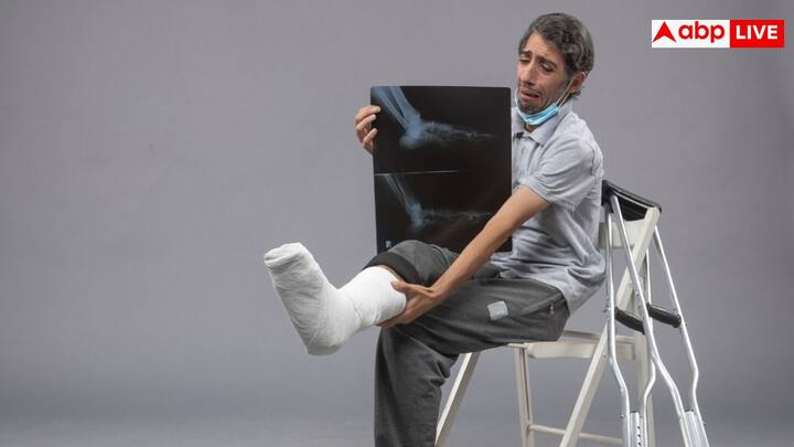 यह तकनीक फ्रैक्चर, दांतों के इम्प्लांट और ऑस्टियोपोरोसिस के मरीजों के लिए बहुत फायदेमंद है. इलाज का समय कम होगा.