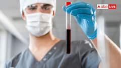 ब्लड ग्रुप CRIB में सी, आर, आई और बी का क्या मतलब है, कैसे पड़ा यह नाम?