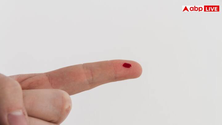 रोटरी बैंगलोर टीटीके ब्लड सेंटर की एडवांस लैब में जांच के बाद सैंपल को यूरोप के IBGRL लेब भेजा गया. वहां लगभग 10 महीने की रिसर्च और जेनेटिक टेस्टिंग में यह नया एंटीजन पाया गया, जिसे CRIB नाम दिया गया.