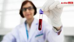 CRIB ब्लड ग्रुप के मरीज का ऑपरेशन हुआ तो क्या होगा, खून की जरूरत पड़ी तो कैसे होगा इलाज?