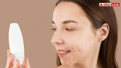 क्या बासी थूक लगाने से सच में सही हो जाते हैं पिंपल्स और सफेद दाग, डॉक्टर से जानें सही बात