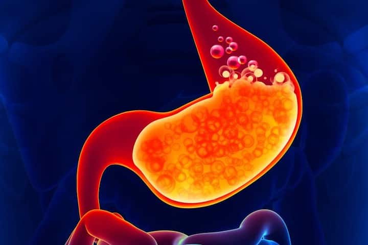 पोटात जळजळ, उलट्या, ढेकर, छातीत जळजळ, आणि अस्वस्थता ही त्याची लक्षणं असतात. औषधांवर अवलंबून न राहता काही सोपे आणि नैसर्गिक घरगुती उपाय अॅसिडिटी कमी करण्यात मदत करू शकतात.