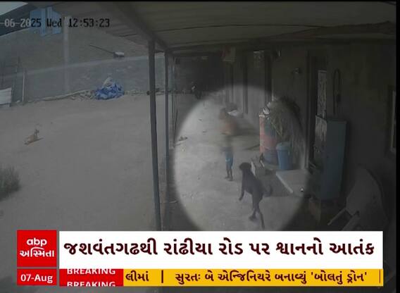 Amreli Dog Attack : અમરેલીમાં 2 વર્ષના બાળક પર શ્વાને કરી દીધો હુમલો, જુઓ અહેવાલ