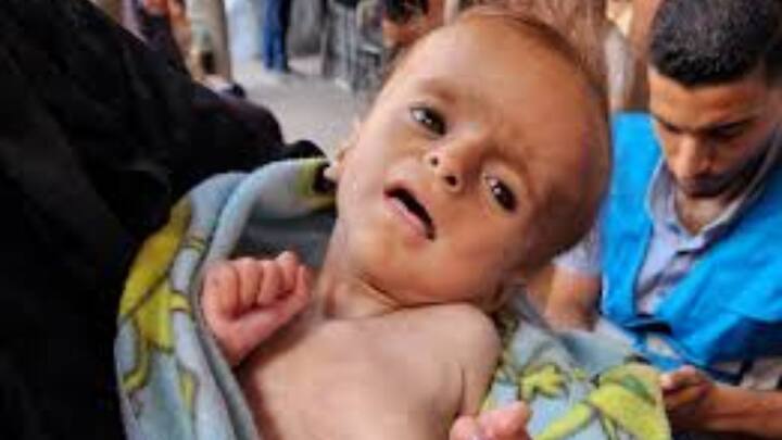 संयुक्त राष्ट्र की रिपोर्ट बताती है कि गाजा की 2.1 मिलियन आबादी को भूख से बचाने के लिए हर दिन 500-600 ट्रक राहत सामग्री की जरूरत है. इसमें खाना, साफ पानी और मेडिकल सप्लाई होनी चाहिए.