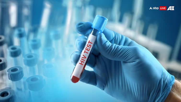 सिर्फ फिजिकल होने से ही नहीं, इन गलतियों से भी हो जाता है HIV AIDS