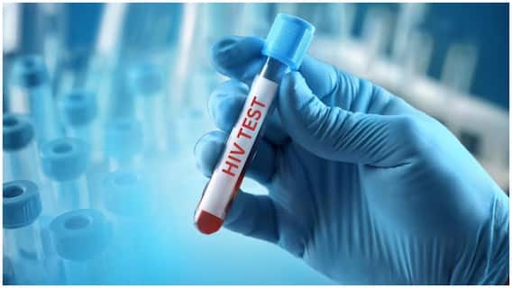 HIV/AIDS Prevention Tips : కేవలం శృంగారం వల్లనే కాదు.. ఈ తప్పుల వల్ల కూడా HIV, AIDS వస్తుంది, జాగ్రత్త