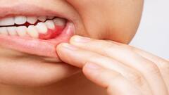 દાંતના પેઢામાંથી લોહી નિકળવું આ 6 બીમારીઓ તરફ કરે છે ઈશારો, સમય રહેતા થઈ જાવ સતર્ક