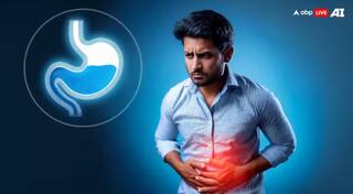 ਪੇਟ 'ਚ ਬਣ ਰਹੀ ਵਾਰ-ਵਾਰ ਗੈਸ, ਕਿਤੇ ਤੁਹਾਡੀ ਡਾਈਟ 'ਚ ਸ਼ਾਮਲ ਆਹ ਚੀਜ਼ਾਂ ਤਾਂ ਨਹੀਂ