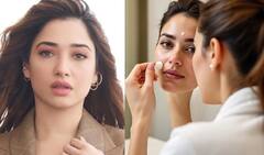 தமன்னாவின் எச்சில் பரு தீர்வு: உண்மை என்ன? மருத்துவர் ஃபரூக் அப்துல்லா எச்சரிக்கை!