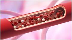 High Cholesterol : కొలెస్ట్రాల్ పెరిగితే మోకాళ్లలో కూడా నొప్పి వస్తుందా? ఈ సంకేతాలు విస్మరిస్తే గుండె పోటే
