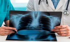 Lung Cancer:ફેફસાના કેન્સર પહેલા શરીર આપે છે આ સંકેત, ભૂલથી પણ ન અવગણશો