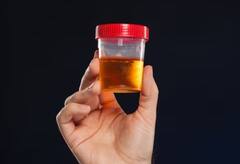 किडनी फेल होने की ओर इशारा करते हैं ये 6 लक्षण, कही आप तो नहीं कर रहे इसे इग्नोर