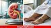 Kidney Disease : কিডনির বিকল হচ্ছে, বলে দেবে আপনার পা-ই ! এই লক্ষণের কথা অনেকেরই অজানা