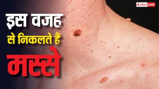 क्यों होते हैं मस्से और ये कितने खतरनाक? जान लें इलाज का सही तरीका