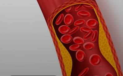 खून की कमी: चनों में आयरन की मात्रा अधिक होती है, जो शरीर में हीमोग्लोबिन का स्तर बढ़ाने में मदद करता है. खासकर महिलाओं के लिए भीगे चने फायदेमंद हैं, क्योंकि यह एनीमिया को रोकने में सहायक होते हैं.
