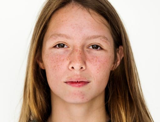 चेहरे पर असामान्य लालिमा या चकत्ते: जब किडनी खराब होती है, तो खून में मौजूद टॉक्सिन बाहर नहीं निकल पाते और स्किन पर असर डालते हैं. चेहरे पर लाल धब्बे, चकत्ते या खुजली इसी वजह से हो सकती है.