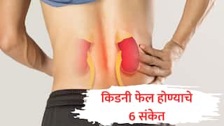 Kidney Failure Symptoms : चेहऱ्यावर हे 6 बदल म्हणजे तुमची किडनी फेल होण्याचे संकेत, वेळीच सावध व्हा