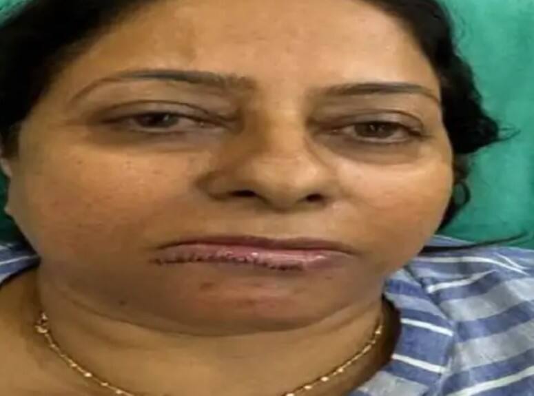 ਐਕਸੀਡੈਂਟ ਦੀ ਸ਼ਿਕਾਰ ਹੋਈ AAP ਵਿਧਾਇਕਾ ਛੀਨਾ ਦੀ ਸਿਹਤ ਨੂੰ ਲੈ ਕੇ ਅਪਡੇਟ ਆਇਆ ਸਾਹਮਣੇ, ਲੱਗੇ 45 ਟਾਂਕੇ, CM ਮਾਨ ਨੇ ਪੁੱਛਿਆ ਹਾਲ-ਚਾਲ