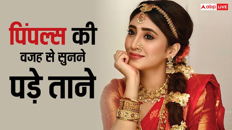 'बड़े अच्छे लगते हैं' की भाग्य़श्री के लिए जब पिंपल्स बनी मुसीबत, सुनी खरी-खोटी बातें, करानी पड़ी दर्दनाक ट्रीटमेंट