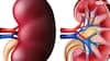 किडनी में सूजन की ओर इशारा करते हैं शरीर में दिखने वाले ये 6 संकेत, तुरंत जाएं डॉक्टर के पास