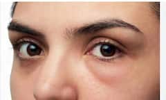 Kidney Health: ਕਿਡਨੀ ਫੇਲ੍ਹ ਹੋਣਾ ਮੌਤ ਵੱਲ ਇਸ਼ਾਰਾ, ਜਾਣੋ ਸਕਿਨ 'ਤੇ ਨਜ਼ਰ ਆਉਣ ਵਾਲੇ ਕਿਹੜੇ ਲੱਛਣ ਜਾਨਲੇਵਾ?