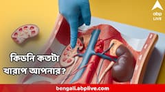 কিডনির অবস্থা কতটা খারাপ, ঘটাতে পারে মৃত্যুও? সঙ্কেত আসে রক্ত আর প্রস্রাবেই! জানুন আগেভাগেই