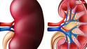 Health Alert: કિડનીમાં સોજો કે અન્ય સમસ્યા હોય તો શરીર આ લક્ષણો દ્વારા આપે છે સંકેત
