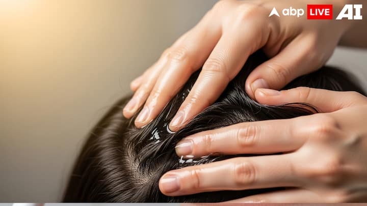 2. Coconut Oil Massage: Coconut oil is filled with antifungal properties and deesply moisturises the scalp. Massaging warm coconut oil into your scalp nourishes the hair roots, reduces dryness, and prevents dandruff formation. This simple remedy strengthens the scalp's barrier and also reduces irritation. This natural oil promotes hair growth, making it a complete solution for healthy hair. (Image Source: ABPLIVE AI)