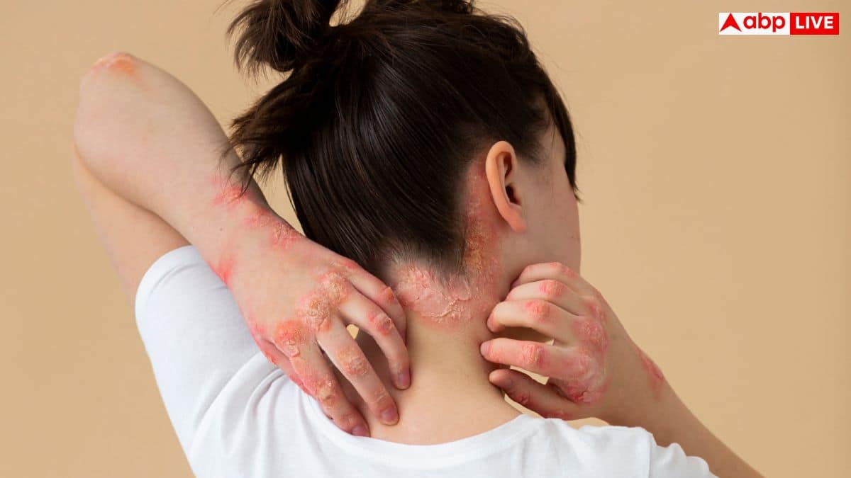 बिना वजह चोट के निशान और कंधे का दर्द हो सकता है ब्लड कैंसर का संकेत, कैसे पहचानें लक्षण?