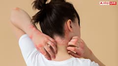 बिना वजह चोट के निशान और कंधे का दर्द हो सकता है ब्लड कैंसर का संकेत, कैसे पहचानें लक्षण?