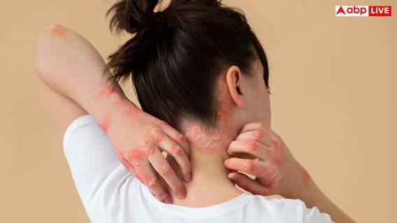 बिना वजह चोट के निशान और कंधे का दर्द हो सकता है ब्लड कैंसर का संकेत, कैसे पहचानें लक्षण?