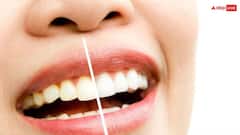 हल्दी से चमकाएं अपने पीले दांत, इस तरह करें इस्तेमाल