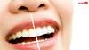 हल्दी से चमकाएं अपने पीले दांत, इस तरह करें इस्तेमाल