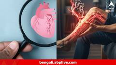 হার্ট অ্যাটাকের ওয়ার্নিং বেল আসতে পারে পায়েও! হাড়ের অসুখ বা পেশিতে টান বলে ভুল করেন অনেকেই