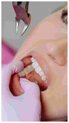 ਕੀ ਤੁਹਾਡੇ ਦੰਦ ਵੀ ਹੋ ਗਏ ਖੋਖਲੇ? ਤਾਂ ਇਸ ਤਰੀਕੇ ਨਾਲ ਕਰੋ ਸਾਫ