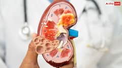 रेनल हाइपरटेंशन क्या है और इसे कैसे करें कंट्रोल, जानिए हेल्दी लाइफस्टाइल के 5 जरूरी कदम