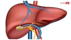 విజయవాడలో 5 నెలల  శిశువుకు విజయవంతంగా లివర్ మార్పిడి 