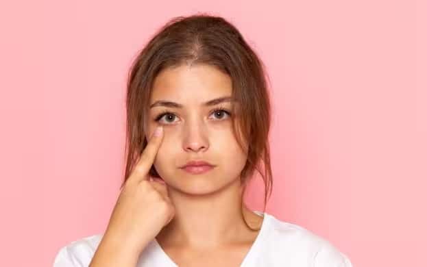 डार्क सर्कल्स कम करने में मददगार: घी की मालिश से आँखों के आसपास की त्वचा को आराम मिलता है और रक्त संचार बढ़ता है। इससे धीरे-धीरे डार्क सर्कल्स कम होने लगते हैं और सूजन भी कम हो सकती है।