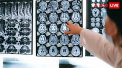 कितना खतरनाक है ब्रेन-ईटिंग अमीबा, क्या ये वाकई खा जाता है इंसानों का दिमाग?