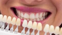 Teeth Health: হলুদ, বাদামি, এমনকি ধূসরও হয়ে যায়, দাঁতের রং দেখে রোগ চিনুন