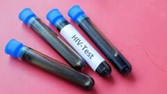 अगर HIV संक्रमित व्यक्ति का खून चूसकर किसी दूसरे व्यक्ति को काट ले मच्छर, क्या तब भी हो जाएगा एड्स