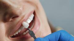 Teeth Health: হলুদ, বাদামি, এমনকি ধূসরও হয়ে যায়, দাঁতের রং দেখে রোগ চিনুন