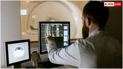 रेडियोलॉजी में बढ़ा AI का इस्तेमाल, फायदे के साथ डरा रहा यह खतरा