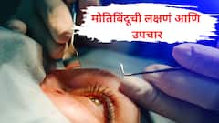 तुम्हालाही अंधुक दिसतंय? मग मोतिबिंदूचे संकेत आहेत, जाणून घ्या कारणे आणि लक्षणे