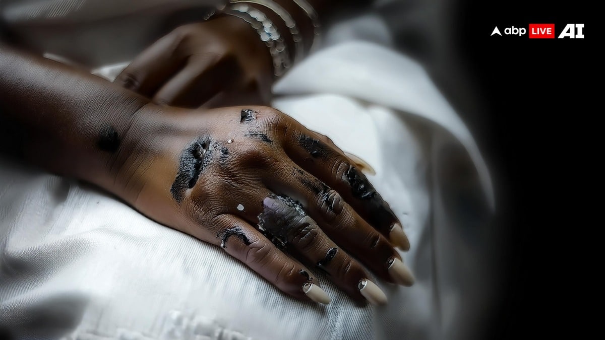 Murshidabad News: স্ত্রীকে খুন করে আত্মহত্যা বলে চালানোর চেষ্টা স্বামীর, দ্বিতীয়বার ময়নাতদন্তে কবর থেকে তোলা হল দেহ