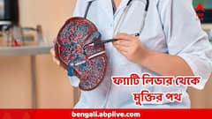 ফ্যাটি লিভার থেকে হতে পারে সিরোসিসও, তবে সেরে ওঠাও সম্ভব, উপায় আপনার হাতেই