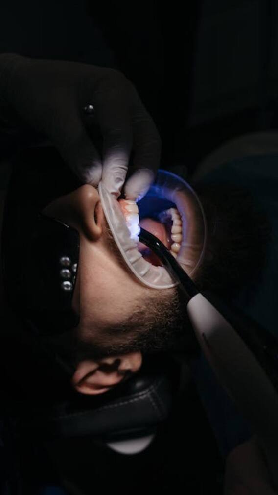 'या' व्हिटॅमिन्सच्या कमतरतेमुळे दात किडतात!