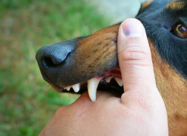 కుక్క కరిచినప్పుడు వచ్చే అతి పెద్ద ప్రమాదకరమైన సమస్య రేబిస్. ఈ వైరస్ మెదడు, నాడీ వ్యవస్థపై దాడి చేస్తుంది. సమయానికి ఇంజెక్షన్లు తీసుకోకపోతే ఇది ప్రాణాంతకం అవుతుంది.