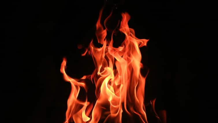 Days After Noida Tragedy, UP Nurse Set Ablaze By Police Constable Husband Over Dowry